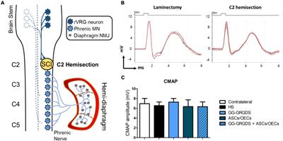 Combination of a Gellan Gum-Based Hydrogel With Cell Therapy for the Treatment of Cervical Spinal Cord Injury